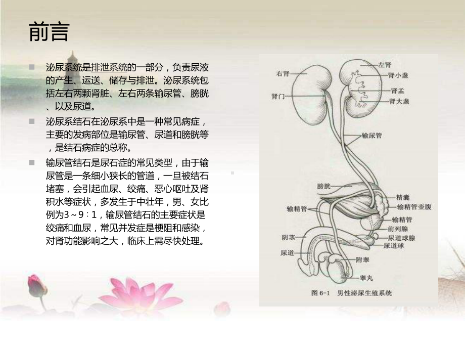 输尿管结石患者的护理查房-课件.ppt_第2页