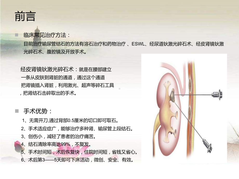 输尿管结石患者的护理查房-课件.ppt_第3页