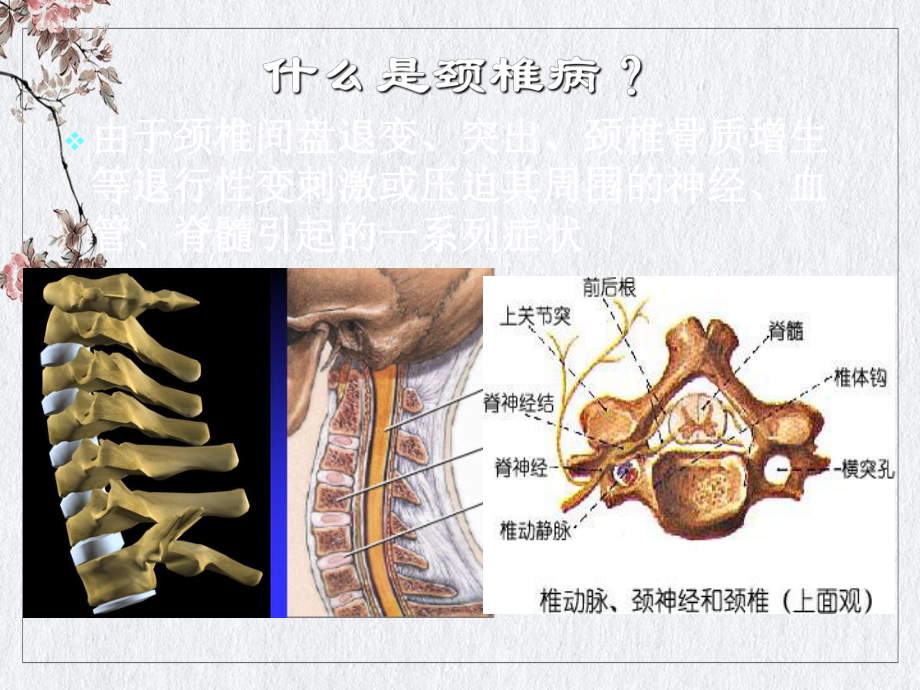 颈椎病分型及治疗讲课课件.pptx_第1页