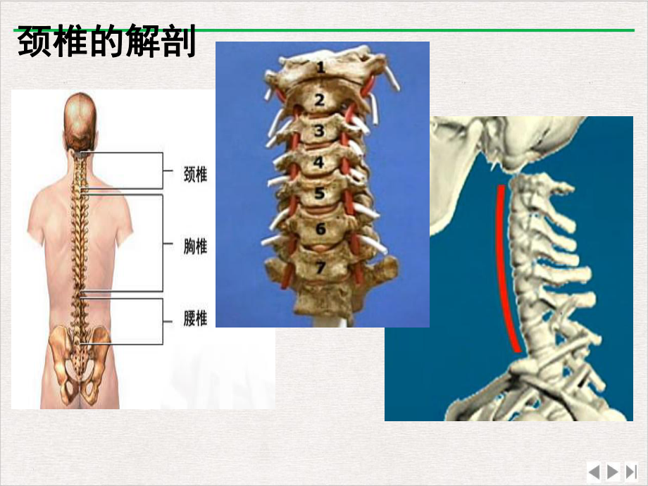 颈椎损伤护理优选课件.pptx_第2页