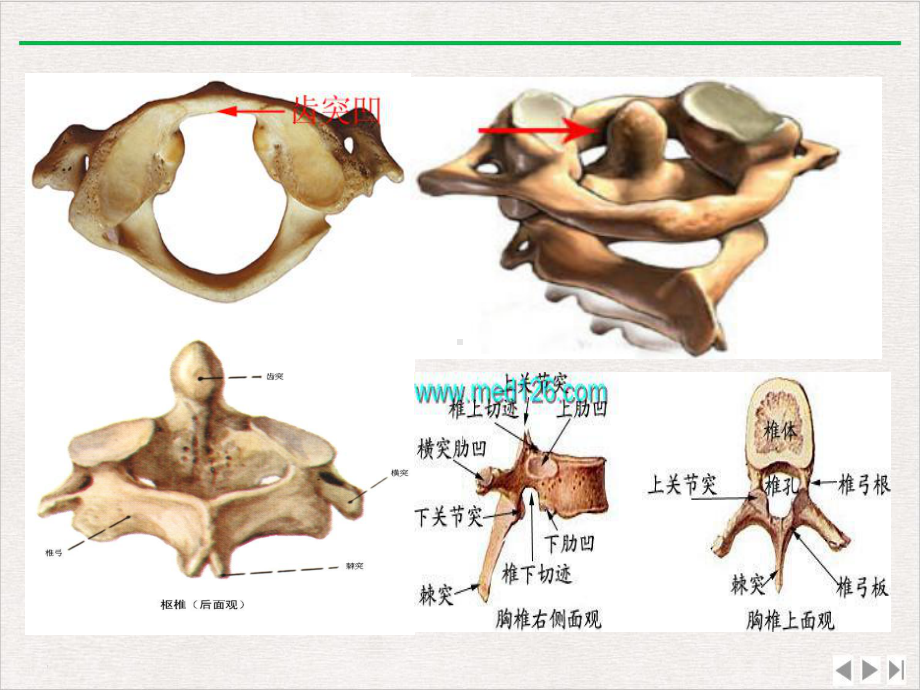 颈椎损伤护理优选课件.pptx_第3页