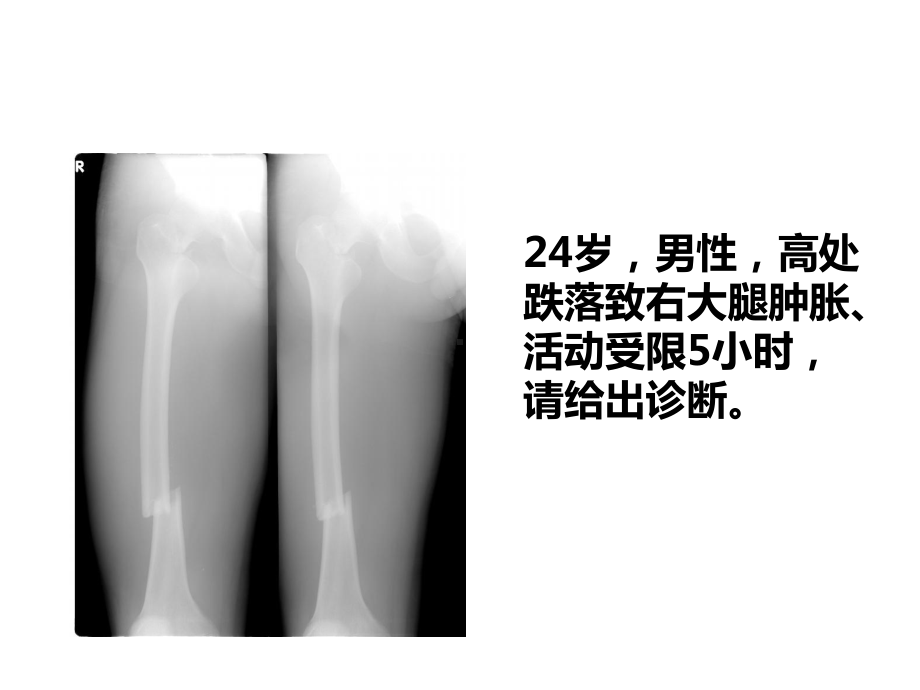 骨科基本技术课件.ppt_第3页