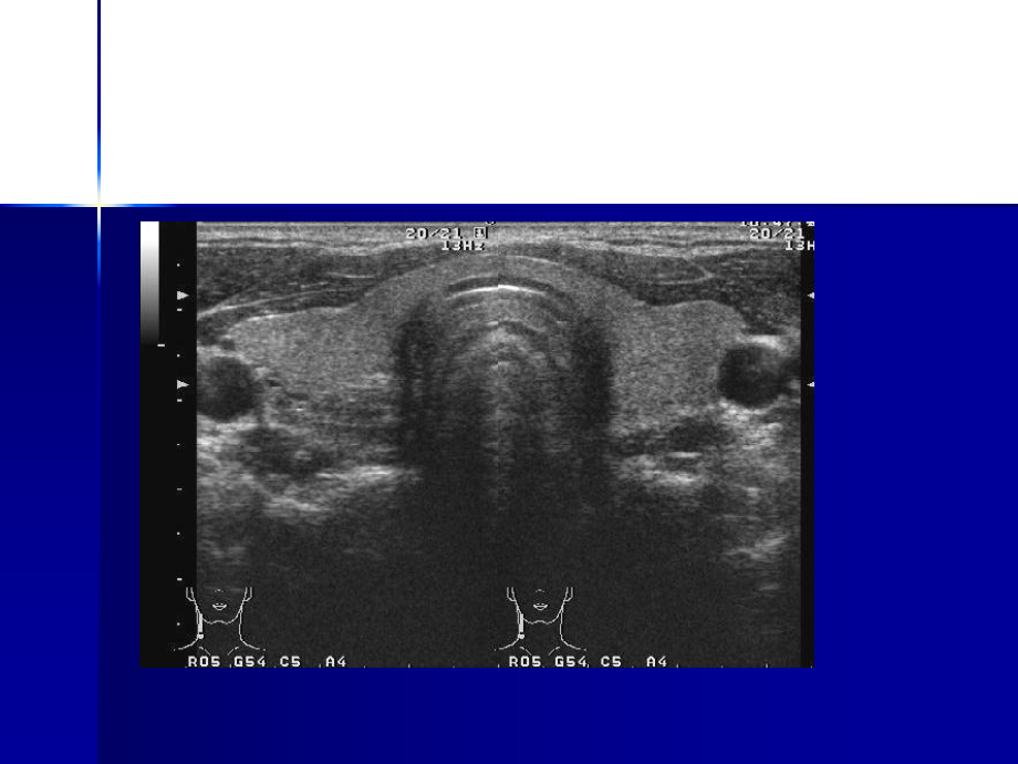 浅表系统超声诊断讲课课件.pptx_第3页