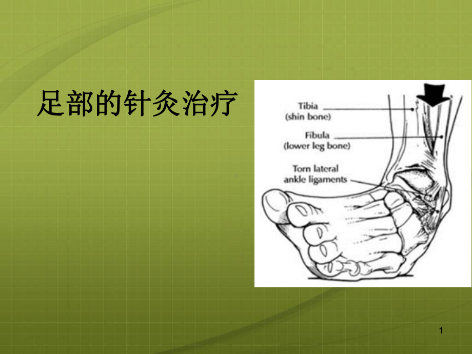 足痛的针灸治疗课件.ppt_第1页