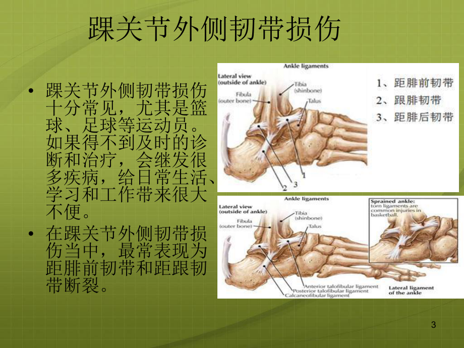 足痛的针灸治疗课件.ppt_第3页