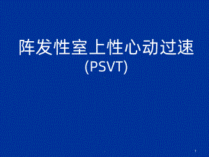 阵发性室上速课件.ppt