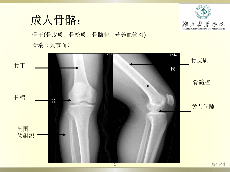 常见骨关节疾病影像专业课件.pptx_第1页