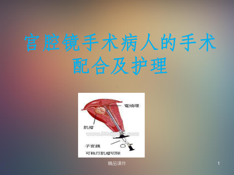 宫腔镜手术病人的手术配合及护理课件1.ppt_第1页