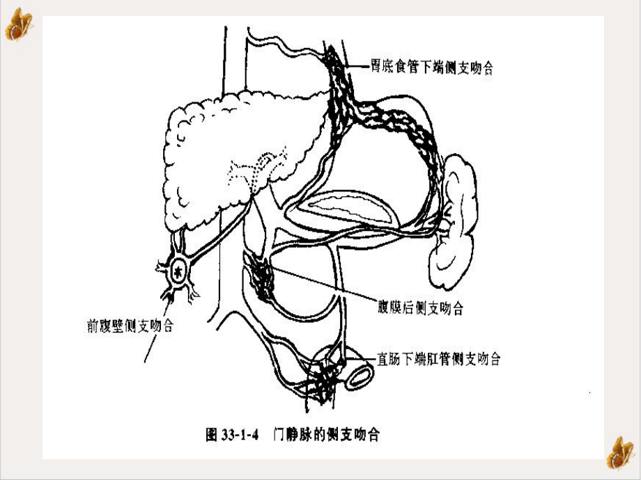 门静脉高压症的发病机制及治疗现状课件.pptx_第1页