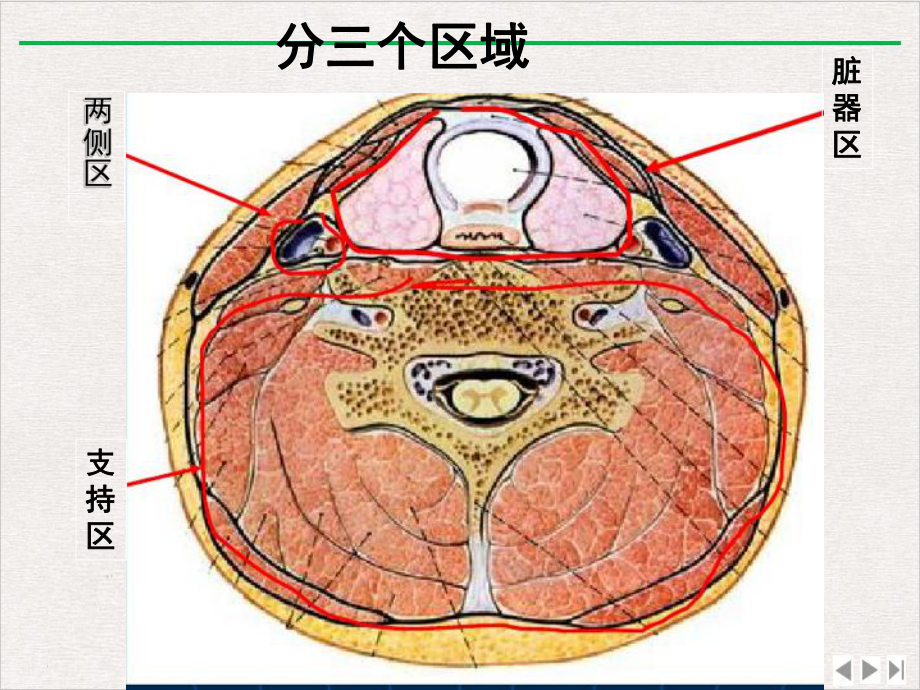 颈部CT断层解剖新版课件.ppt_第3页