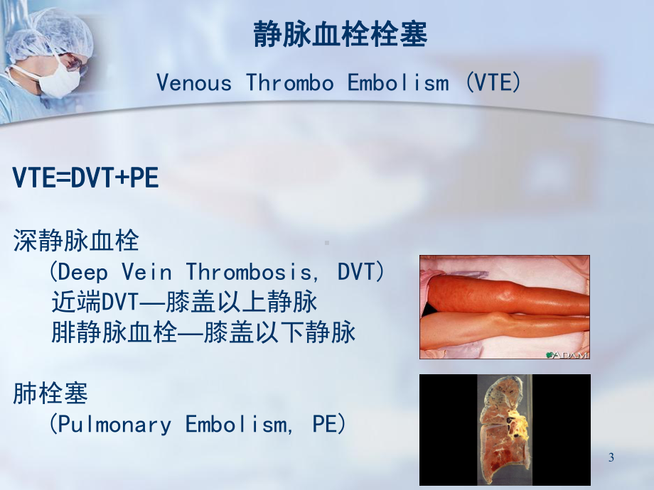 骨科深静脉血栓的预防课件.ppt_第3页