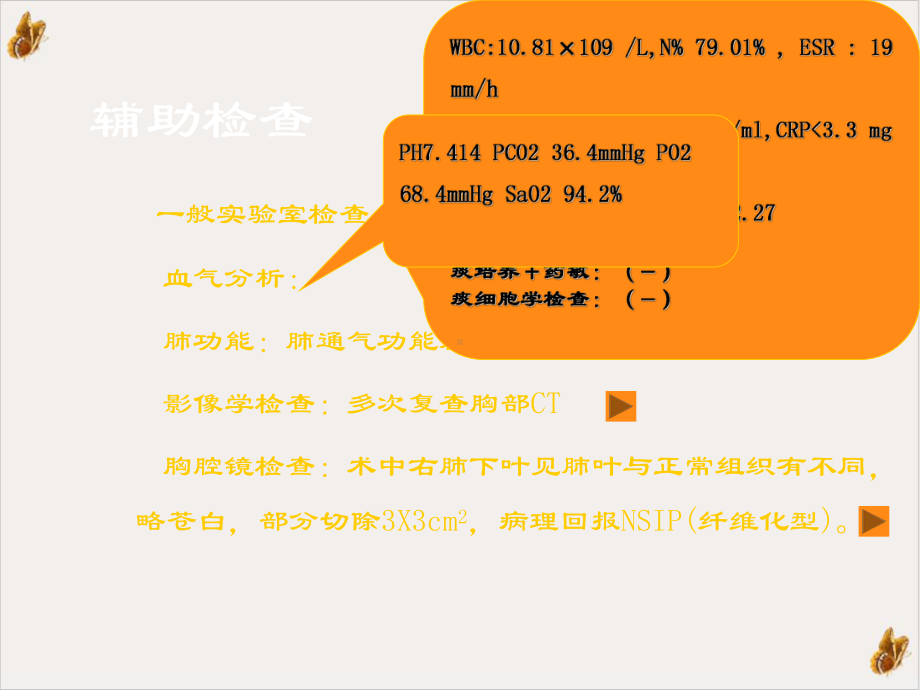 非特异性间质性肺炎病例分析教学课件.pptx_第2页