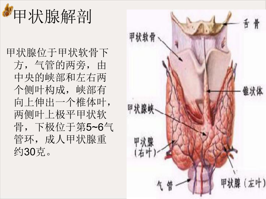 护理教学查房甲状腺课件.ppt_第3页