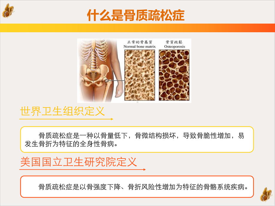 骨质疏松健康讲座培训课件.pptx_第2页