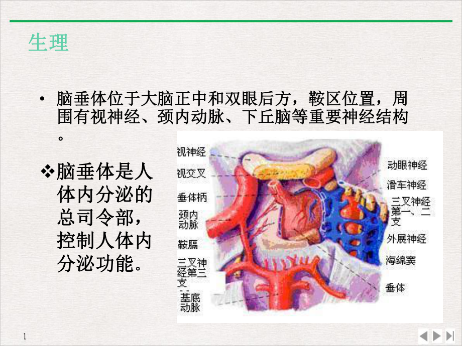 黄妹垂体腺瘤的护理查房课件.pptx_第2页