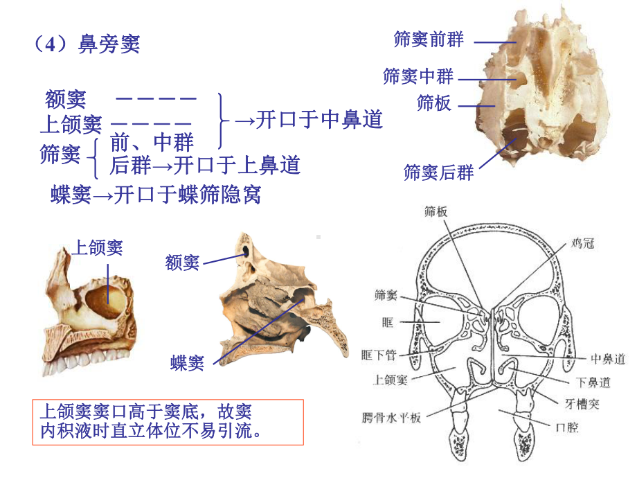 颅脑影像解剖与病变3课件.ppt_第2页