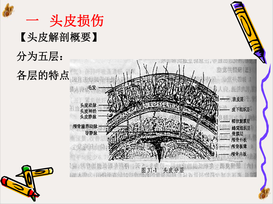 颅脑损伤病人护理副本培训课程课件.pptx_第2页