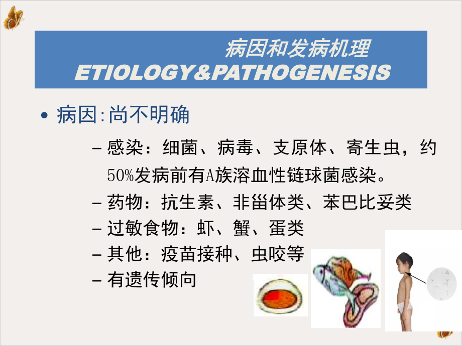 过敏性紫癜个人整理ppt课件.pptx_第2页