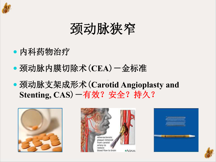 颈动脉cas术中术后并发症的防治课件1.pptx_第1页