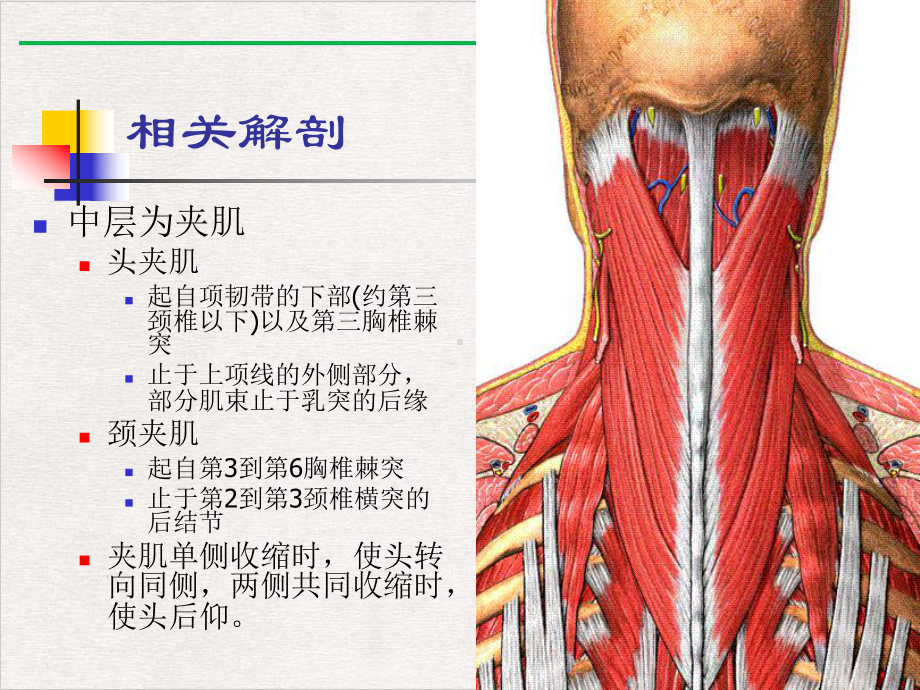 颈肌损伤型颈椎病新版课件.pptx_第3页