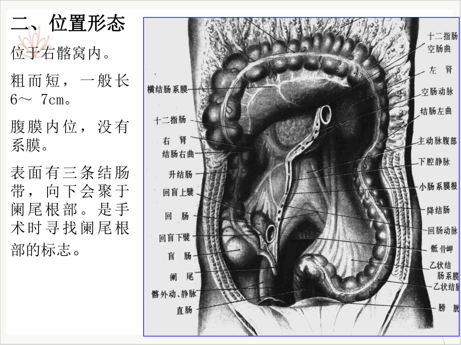 阑尾切除的临床解剖课件.pptx_第2页