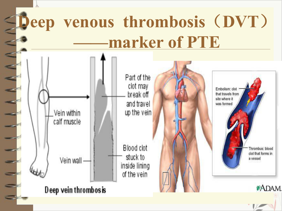 静脉血栓栓塞症病理生理的前沿问题课件.pptx_第2页