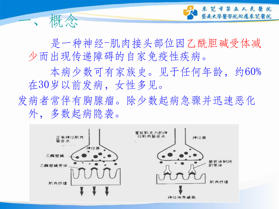 重症肌无力的护理(同名1311)课件.ppt_第2页