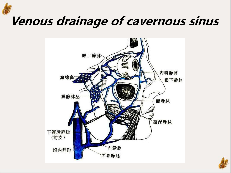 颈内动脉海绵窦瘘课件.pptx_第3页