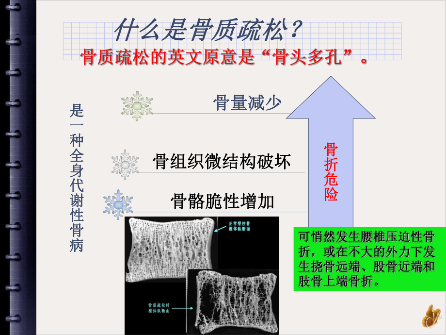 骨质疏松症的理论培训课件.pptx_第2页