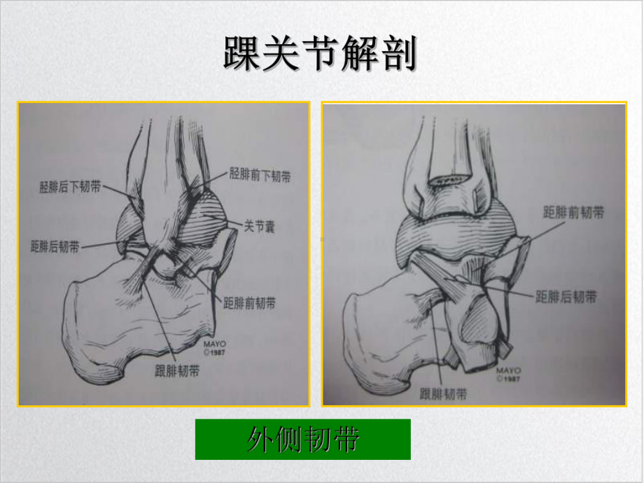 踝关节影像诊断课件整理.ppt_第3页