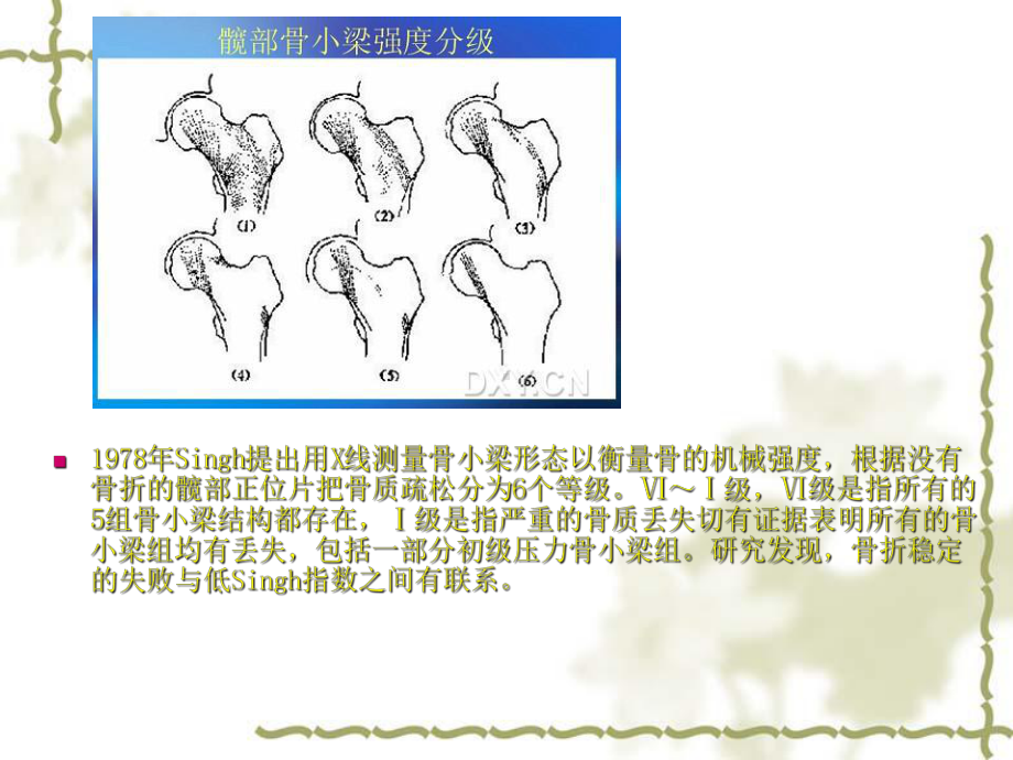 人工关节置换术课件.ppt_第3页