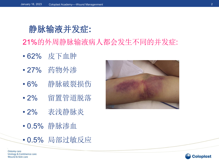 静脉炎的分类与处理剖析课件.ppt_第2页