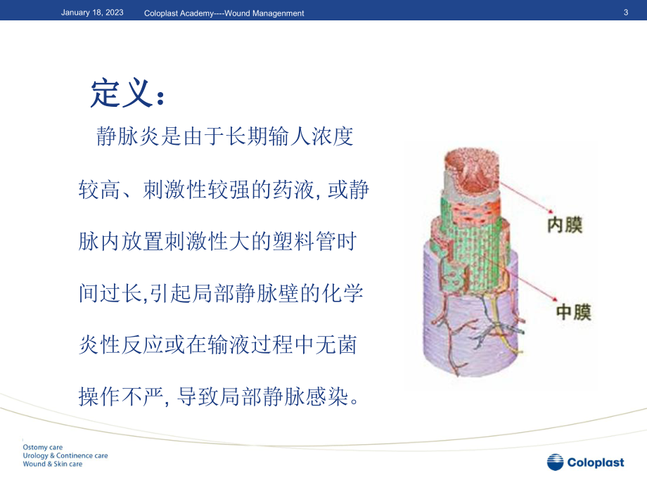 静脉炎的分类与处理剖析课件.ppt_第3页