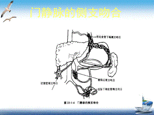 门静脉高压症的诊治课件.pptx