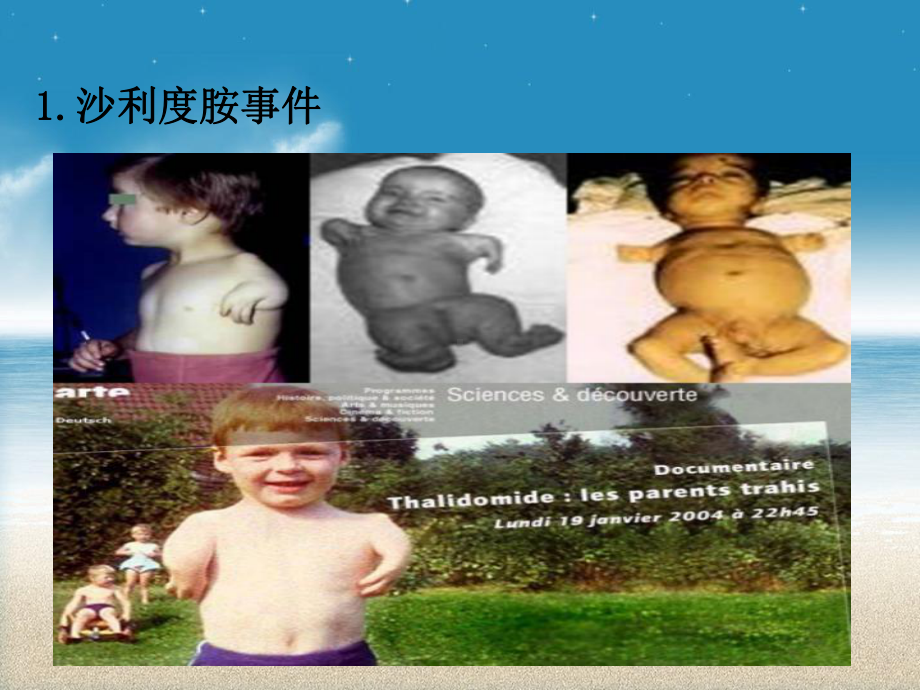 药品不良反应培训(护理)课件.ppt_第2页