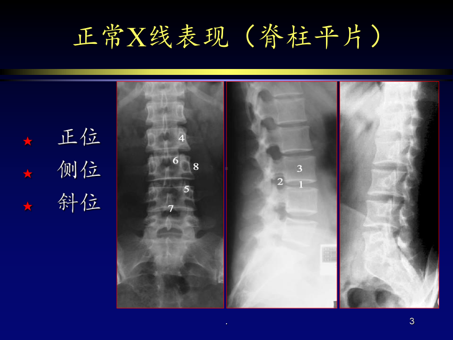 脊柱病变课件.ppt_第3页