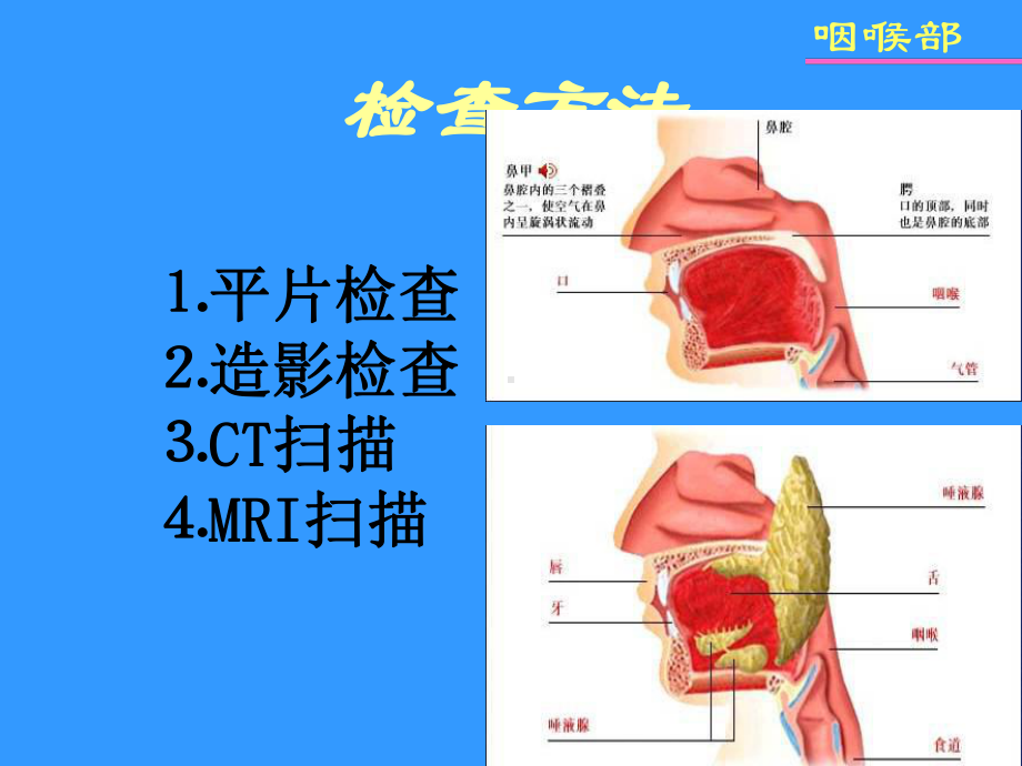 鼻咽及喉部影像学诊断课件.ppt_第3页