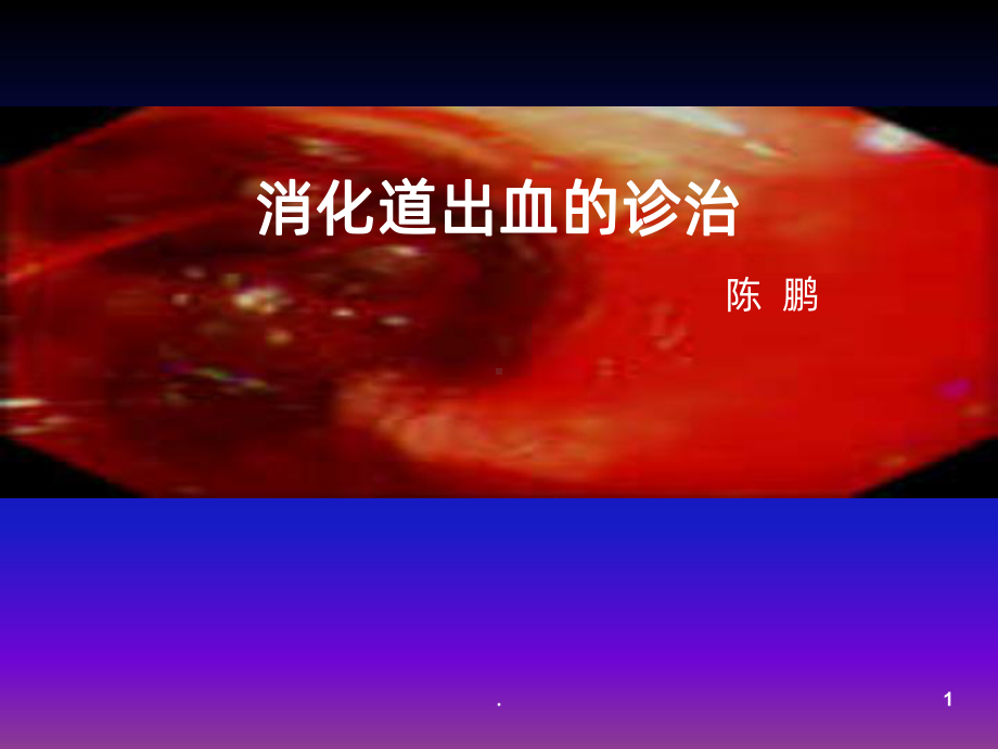 消化道出血的诊治课件.ppt_第1页