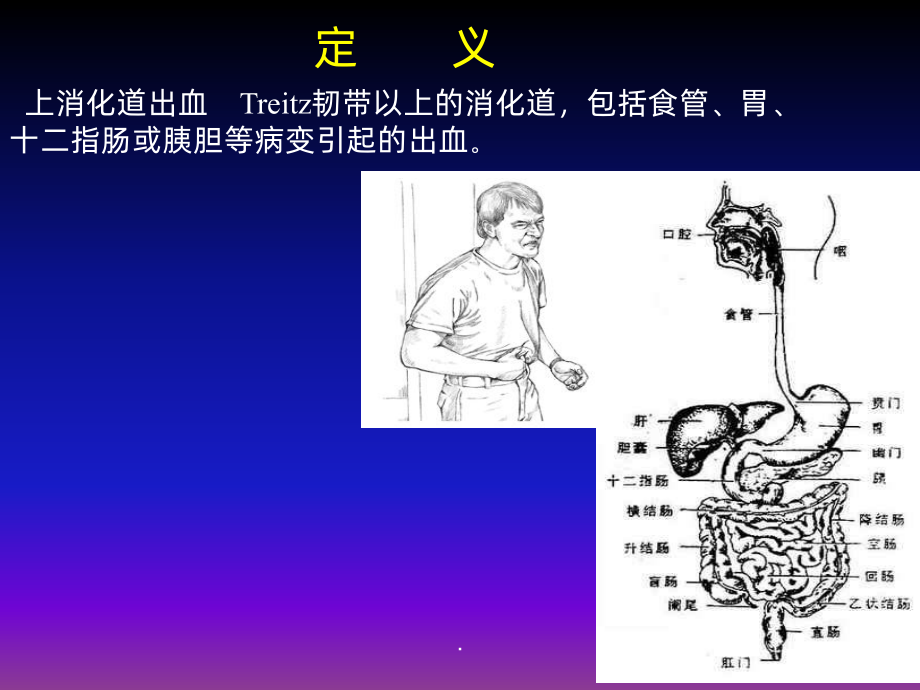 消化道出血的诊治课件.ppt_第2页