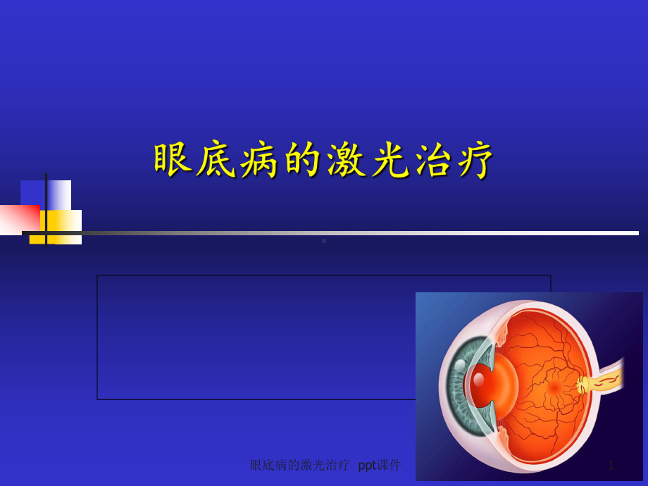 眼底病的激光治疗-课件.ppt_第1页