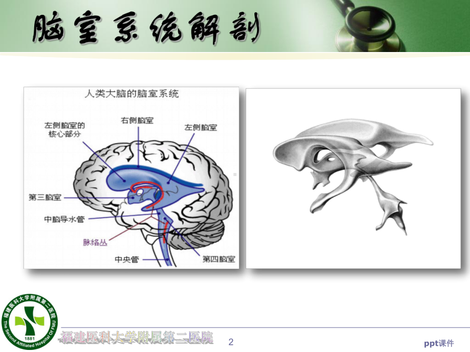 侧脑室外引流-课件.ppt_第2页