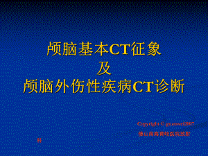 颅脑基本CT征象及颅脑外伤性疾病CT诊断课件.ppt