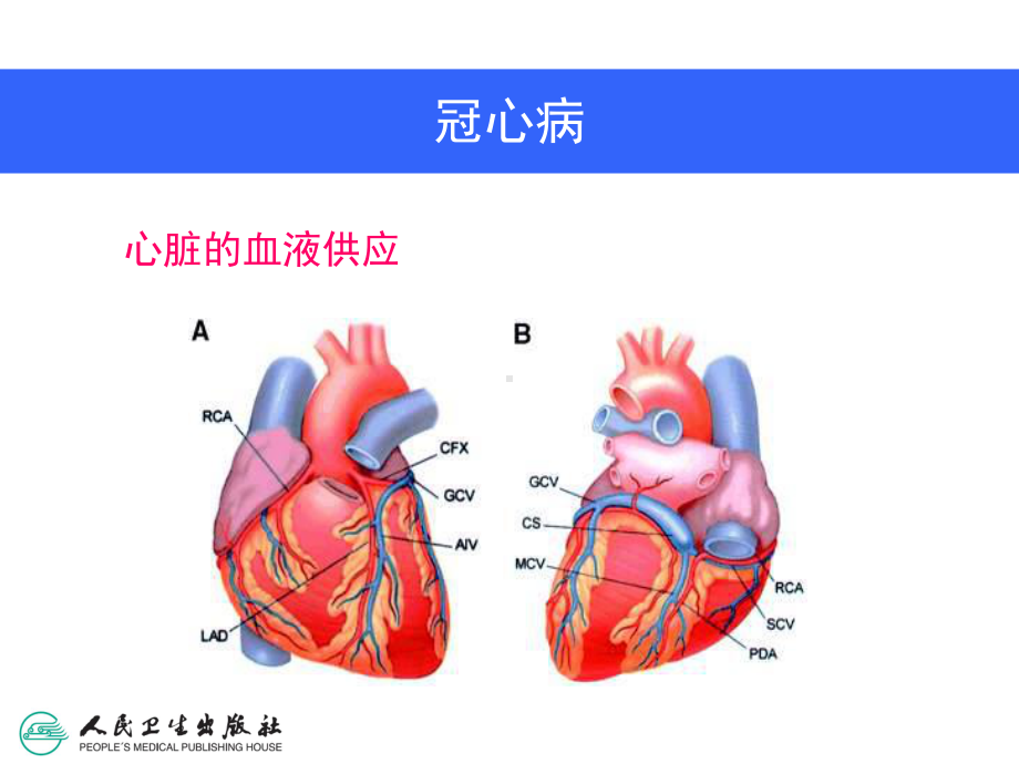 冠状动脉旁路移植术课件.ppt_第3页