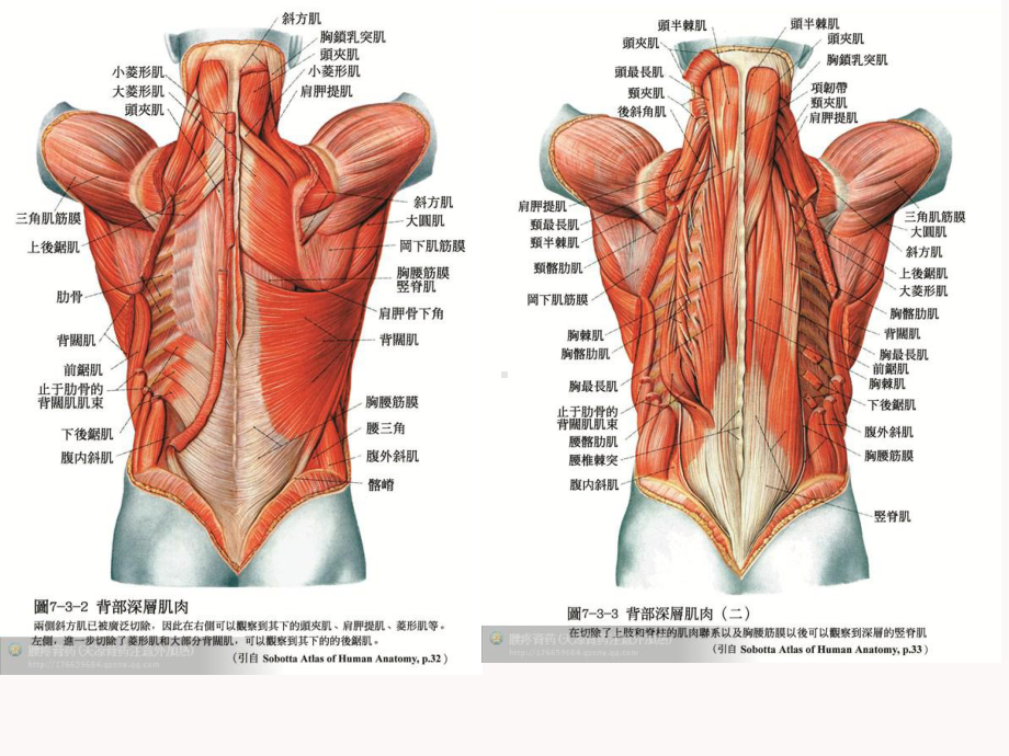 上交叉综合征课件.ppt_第3页