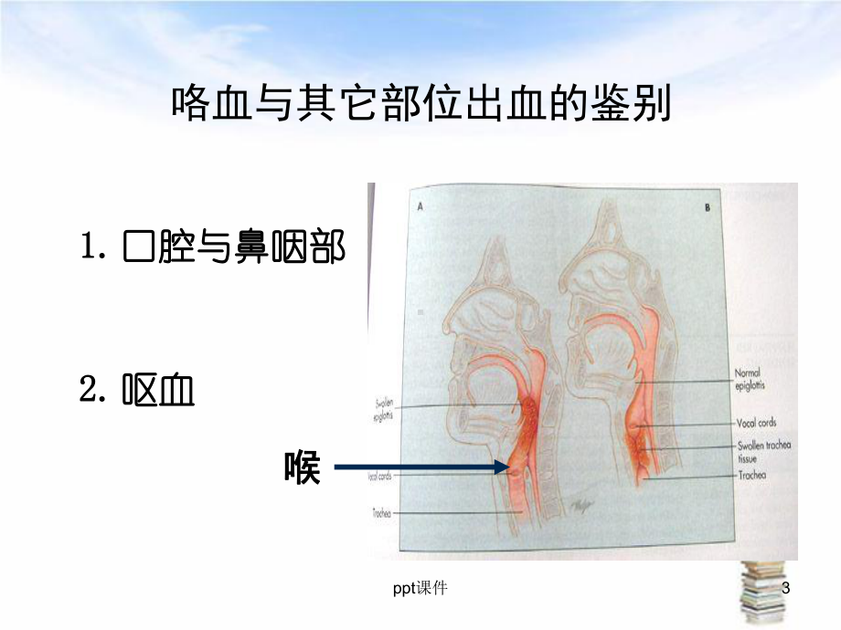 咯血的诊断与处理-课件.ppt_第3页