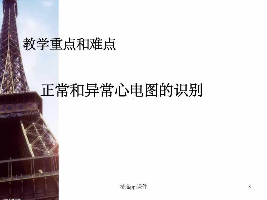 《心律失常护理》课件.ppt_第3页