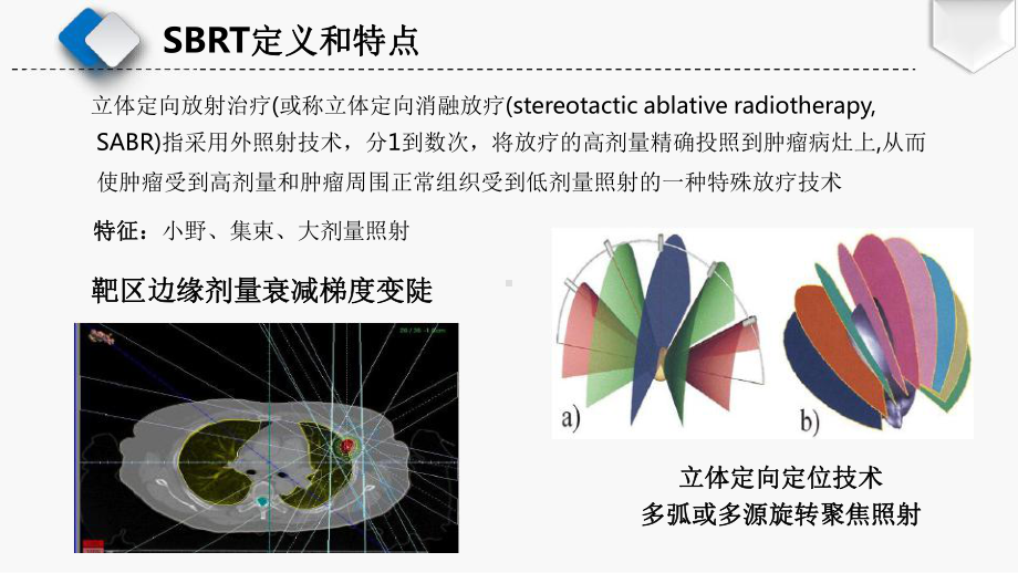 早期肺癌立体定向放疗课件.pptx_第3页