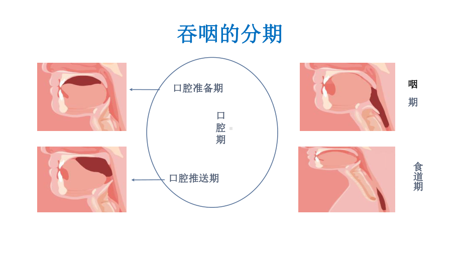 （临床营养管理）-吞咽障碍-与饮食管理课件.pptx_第3页