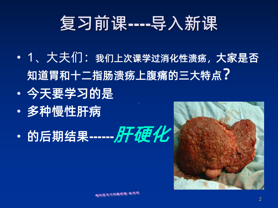 《肝硬化完整》课件.ppt_第2页