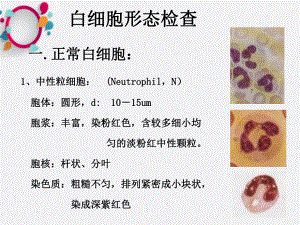 《白细胞形态检查》课件.ppt